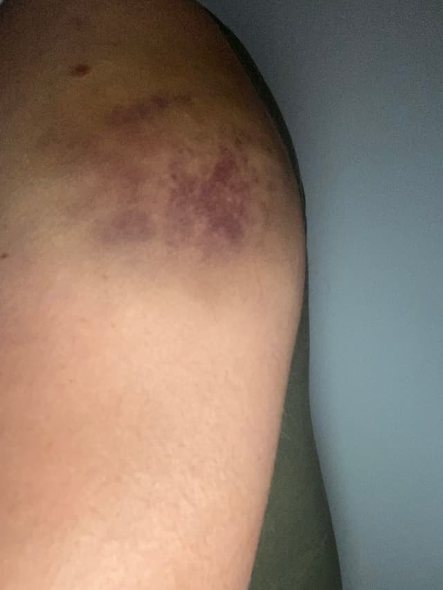 Brutalnost nad ratnim veteranima u Novom Sadu 5. septembra